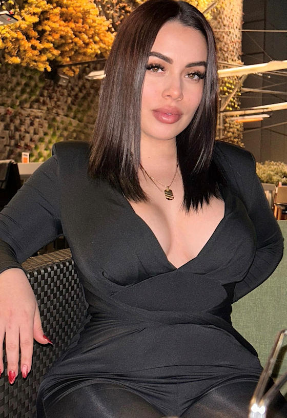 escorts Madrid